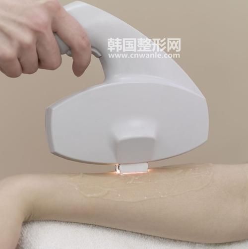 無痛冰點(diǎn)脫毛