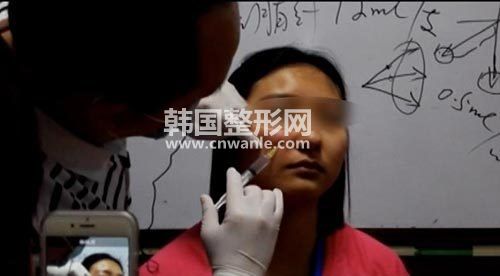 <a href='/tag_weizhengxing3.html'>微整形</a>疼不疼