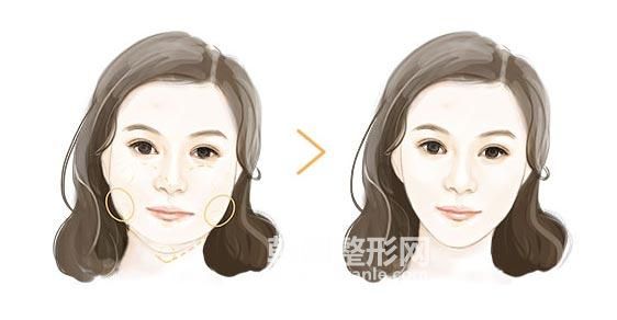 <a href='/tag_zhushe169.html'>注射</a><a href='/tag_rongzhizhen11.html'>溶脂針</a>注意事項(xiàng)