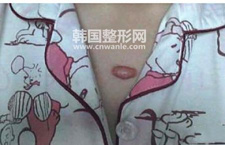 /uploads/files_user1/article/5ecf6efcba46c375294.jpg