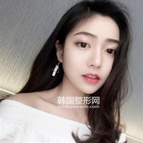 電波<a href='/tag_lapi2.html'>拉皮</a>的作用是什么?