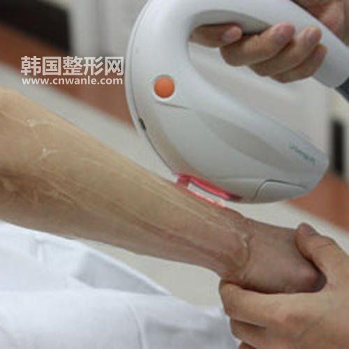 電波<a href='/tag_lapi2.html'>拉皮</a>術(shù)后注意事項
