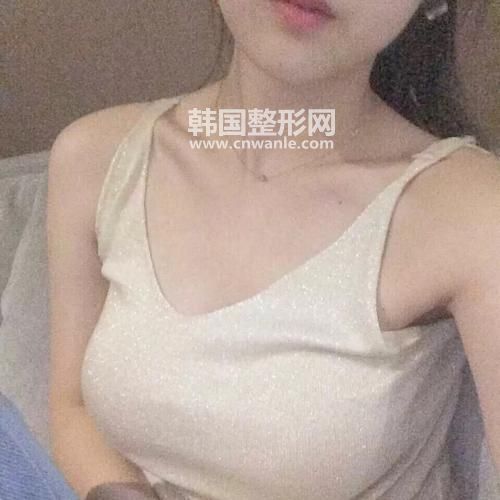 <a href='/tag_jiati95.html'>假體</a>豐胸手感和真的一樣嗎？和真實(shí)手感差別大嗎？