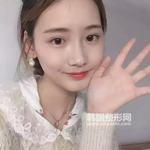 <a href='/tag_mianbutisheng17.html'>面部提升</a><a href='/tag_quzhou26.html'>祛皺</a>有什么好方法？