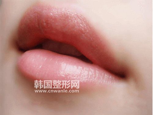 口角成型<a href='/tag_zhengxingshoushu5.html'>整形手術(shù)</a>前和術(shù)后需要注意的事項有哪些?