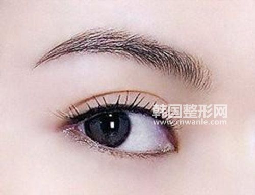 割<a href='/tag_shuangyan108.html'>雙眼</a>皮時為什么一般還要<a href='/tag_kaiyanjiao68.html'>開眼角</a>？