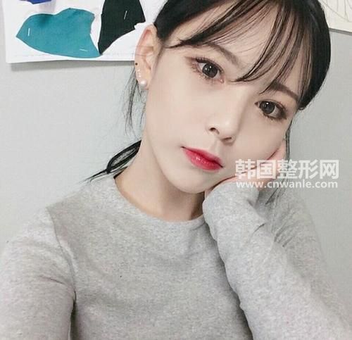 3D生態(tài)納米隆鼻與傳統(tǒng)隆鼻比較的優(yōu)勢有哪些？