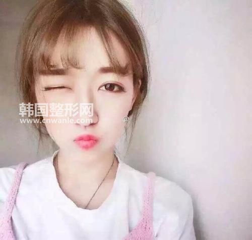 韓國本地人去的整形醫(yī)院有哪些?