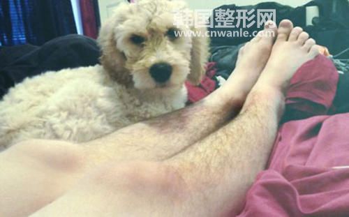 冰點脫毛和激光脫毛哪個好？