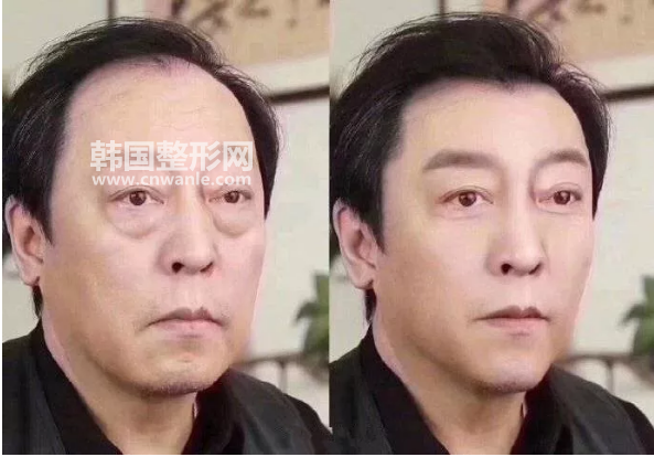 <a href='/tag_wocan4.html'>臥蠶</a>是什么？