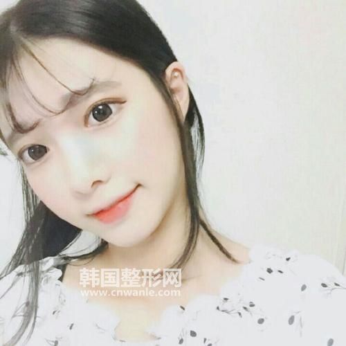 <a href='/tag_tuchun9.html'>兔唇</a>唇裂疤痕修復(fù)的方法有哪些？