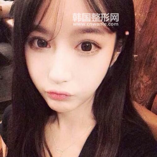 <a href='/tag_maixian35.html'>埋線</a><a href='/tag_shuangyan108.html'>雙眼</a>皮斷了怎么辦？如何修復(fù)？