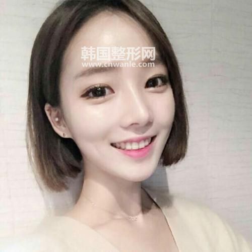       很多人理解<a href='/tag_wocan4.html'>臥蠶</a>和<a href='/tag_yandai21.html'>眼袋</a>容易混淆。臥蠶是我們中國人用來形容的名稱，相當貼切生動，臥蠶是緊鄰<a href='/tag_jiemao3.html'>睫毛</a>下緣一條約四到七毫米帶狀隆起物，看來好像一條蠶寶寶橫臥在下睫毛的邊緣，笑起來才明顯，讓眼神變得可愛。眼袋雖然也是一團凸出物，但距離下睫毛較遠，是大量脂肪堆積在人的下眼瞼皮下組織中久而久之形成的一半圓形的袋狀物，主要是脂肪凸出所致。分辨的方法是眼袋是三角型，但臥蠶是橢圓型；眼袋不論臉部表情為何都會出現(xiàn)，臥蠶笑起來才會特別明顯?；旧嫌信P蠶的人看起來好象眼睛會笑，是十分有魅力的眼睛，與眼袋肌膚問題截 然不同。有臥蠶表示異性緣很好！