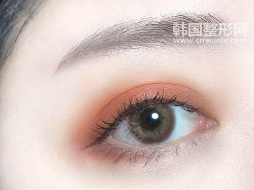 做完埋線<a href='/tag_shuangyanpi53.html'>雙眼皮</a>失敗了怎么辦，兩邊不對(duì)稱很郁悶??！