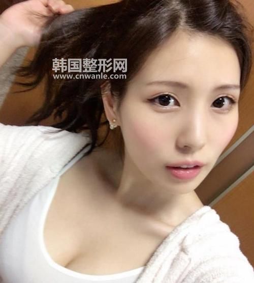 去<a href='/tag_yandai21.html'>眼袋</a>大概需要多少錢？