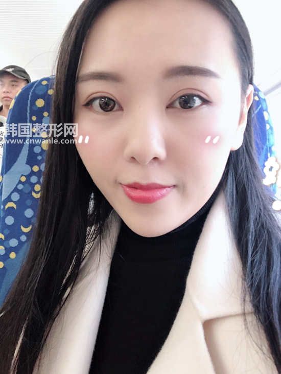 割<a href='/tag_shuangyan108.html'>雙眼</a>皮有并發(fā)癥嗎 全切<a href='/tag_shuangyanpi53.html'>雙眼皮</a>的后遺癥