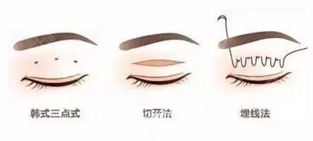<a href='/tag_maixian35.html'>埋線</a><a href='/tag_shuangyan108.html'>雙眼</a>皮注意事項(xiàng)有哪些？