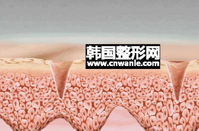 /uploads/article/20200402/6091773241e91a5a791ea13ef7982c7f.gif
