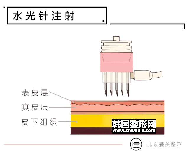 /uploads/article/20200402/42f7682737f645c43fe415396b7112be.gif
