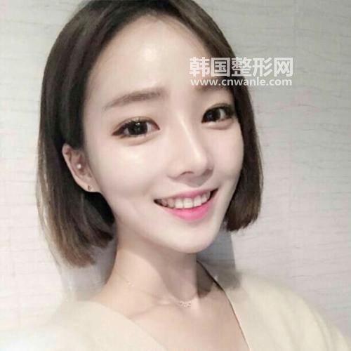 <a href='/tag_fuhecaiguang2.html'>復(fù)合彩光</a><a href='/tag_nenfu2.html'>嫩膚</a>