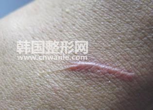 /uploads/files_user1/article/5ecb656d500e1747967.jpg