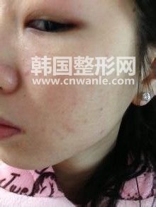 /uploads/files_user1/question/5ec7a0413fa25751210.jpg
