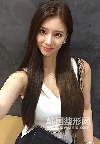雙眼皮眼睛埋線幾年后的危害是什么?