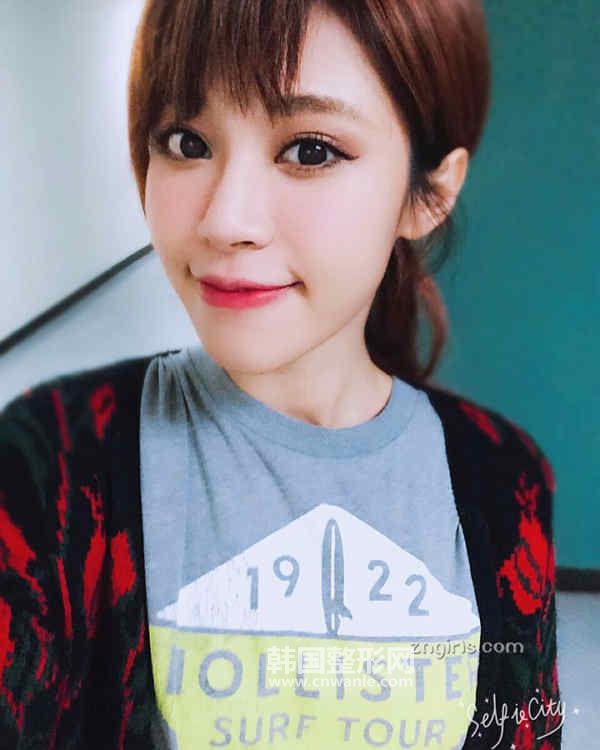 去<a href='/tag_yuweiwen4.html'>魚尾紋</a>一般要多少錢？