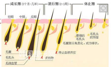 激光脫毛