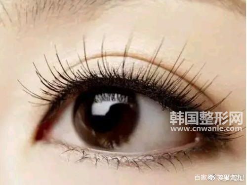 微創(chuàng)雙眼皮手術(shù)多久可以洗臉 術(shù)后如何護(hù)理
