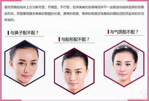 如何更根據(jù)臉型選擇適合自己的<a href='/tag_shuangyan108.html'>雙眼</a>皮術(shù)？