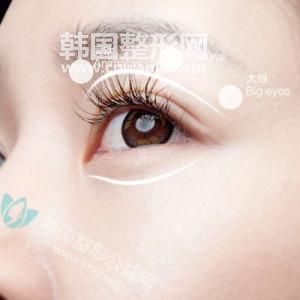 關(guān)于<a href='/tag_shuangyan108.html'>雙眼</a>皮手術(shù)的一些事情
