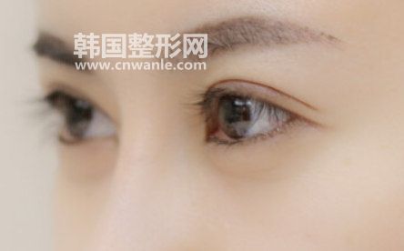 為什么要做<a href='/tag_shuangyanpishoushu6.html'>雙眼皮手術(shù)</a>？
