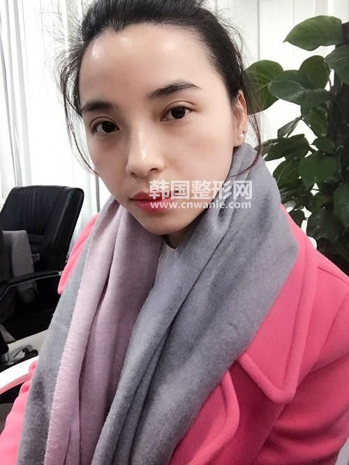 北京八大處割<a href='/tag_shuangyan108.html'>雙眼</a>皮有哪些方式？多少錢？