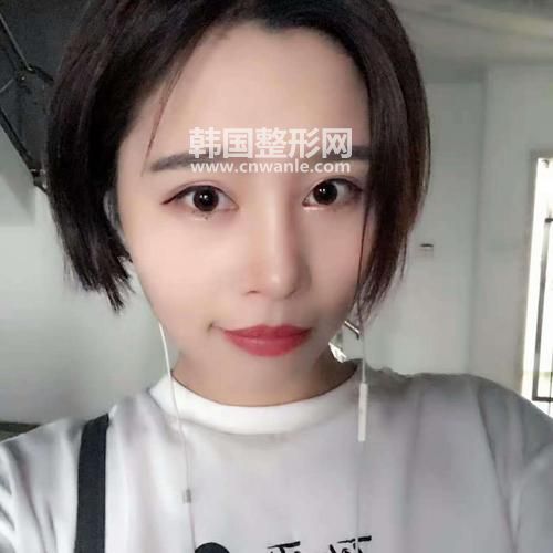 <a href='/tag_maixian35.html'>埋線</a><a href='/tag_shuangyan108.html'>雙眼</a>皮效果圖 埋線<a href='/tag_shuangyanpi53.html'>雙眼皮</a>能保持多久