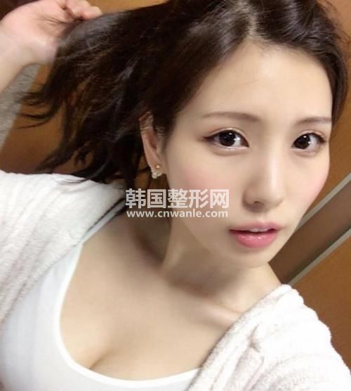 <a href='/tag_kaiwaiyanjiao4.html'>開外眼角</a>有哪些效果？