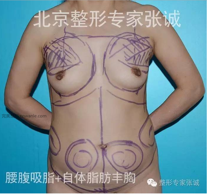 J0K完美整形-全國(guó)韓式整形美容醫(yī)院在線咨詢平臺(tái)