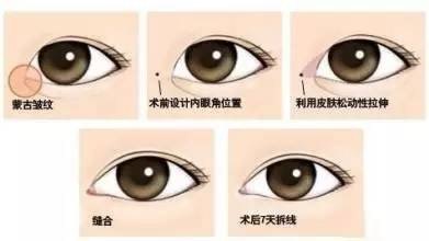 O3c完美整形-全國韓式<a href='/tag_zhengxingmeirongyi6.html'>整形美容醫(yī)院</a>在線咨詢平臺
