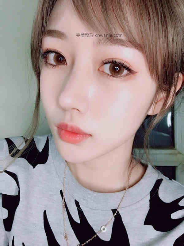 北京隆鼻哪個專家比較好 <a href='/tag_longbiyisheng.html'>隆鼻醫(yī)生</a>前十排行榜