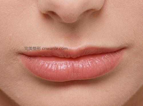 <a href='/tag_houchun2.html'>厚唇</a>變薄術(shù)后有疤嗎？
