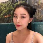 敏敏玻尿酸豐面頰術后75天 圖5