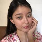 敏敏玻尿酸豐面頰術后91天 圖4