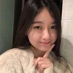 敏敏玻尿酸豐面頰術后138天 圖2