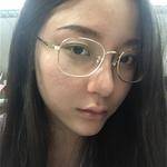 敏敏玻尿酸豐面頰術后3天 圖3
