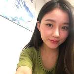 敏敏玻尿酸豐面頰術后83天 圖1