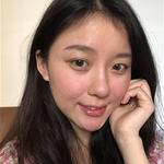 敏敏玻尿酸豐面頰術后91天 圖3