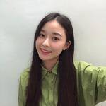 敏敏玻尿酸豐面頰術后60天 圖1