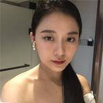 敏敏玻尿酸豐面頰術后210天 圖4
