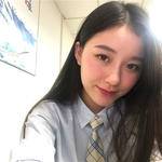 敏敏玻尿酸豐面頰術后83天 圖4