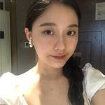 敏敏<a href='/tag_boniaosuan41.html'>玻尿酸</a><a href='/tag_fengmianjia.html'>豐面頰</a>術后210天 圖1